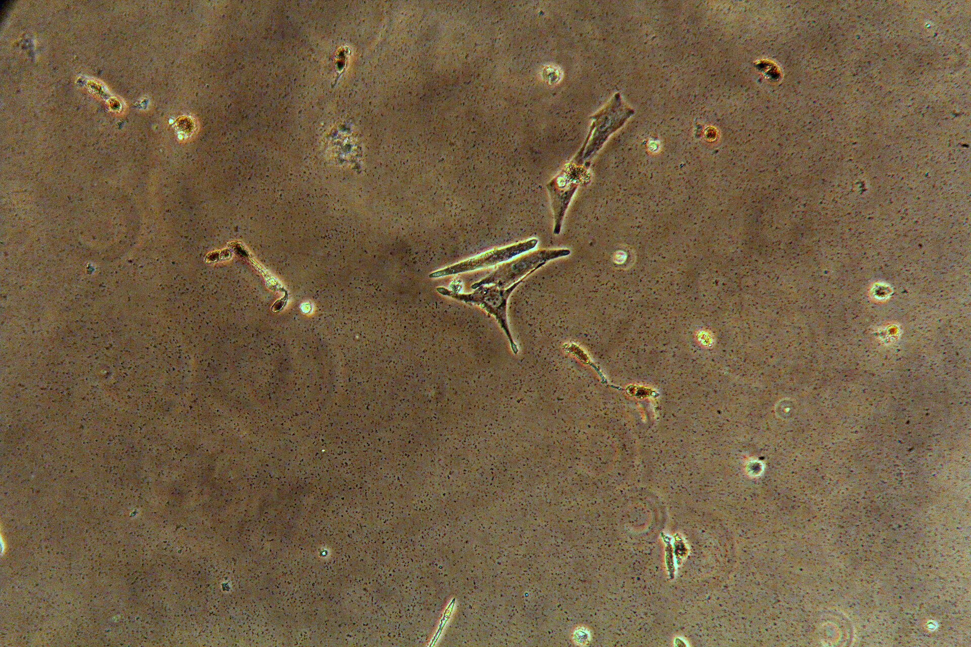 Mus musculus melanoma skin cancer cells in UFV